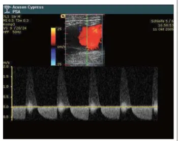 Abbildung 4:  Darstellung der rechten Niere im Zustand nach Nierenarterienembolie vor einem Jahr (Acuson Cypress ® , 4C1 Curved Array-Transducer; 4 MHz)