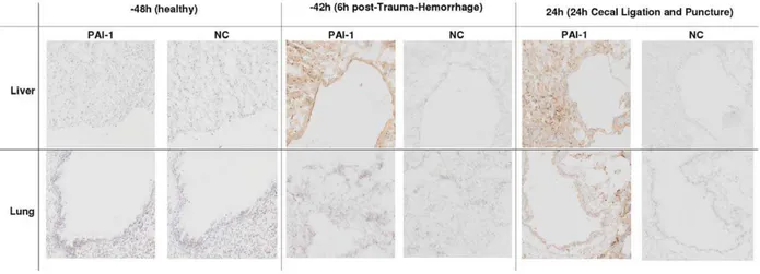 Figure 4. Immunohistochemical staining of PAI-1 in the liver and lung post-TH and TH-CLP