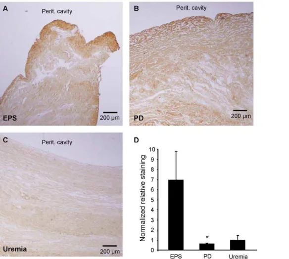 Figure 7. Immunohistochemical expression patterns of collagen 1 a 1 (Col1a1) polypeptide in peritoneal biopsy samples