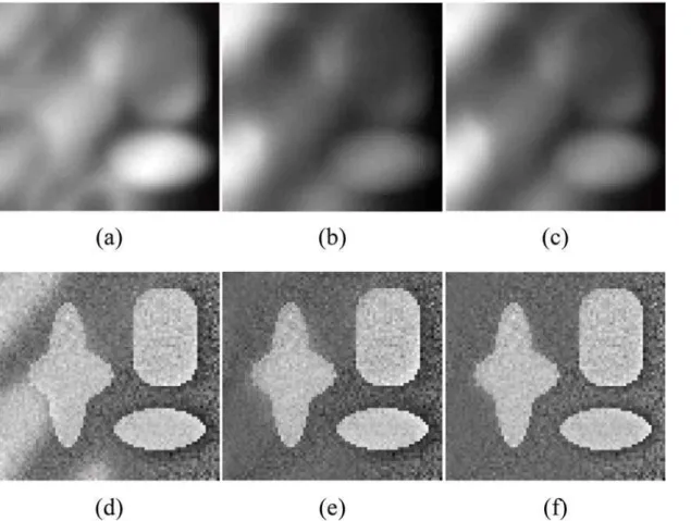Fig 7. Comparisons of the bias field estimation and corrected image for Fig. 6 between Li ’ s model, LSACM and our model