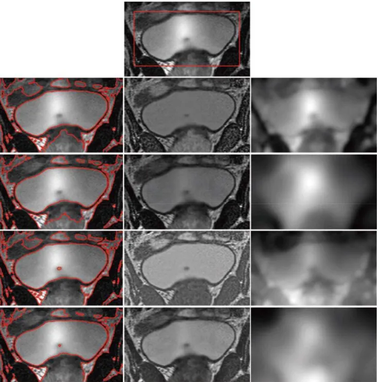 Fig 9. Comparisons of Li ’ s model and our model in different scale σ on MR image. Row 1 is the original image with red initial contours