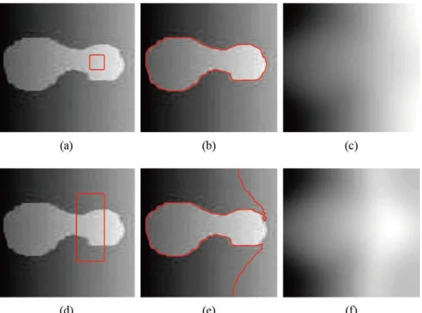 Fig 3. Segmentation of Li ’ s model. (a), (d) The original image with red initial contours