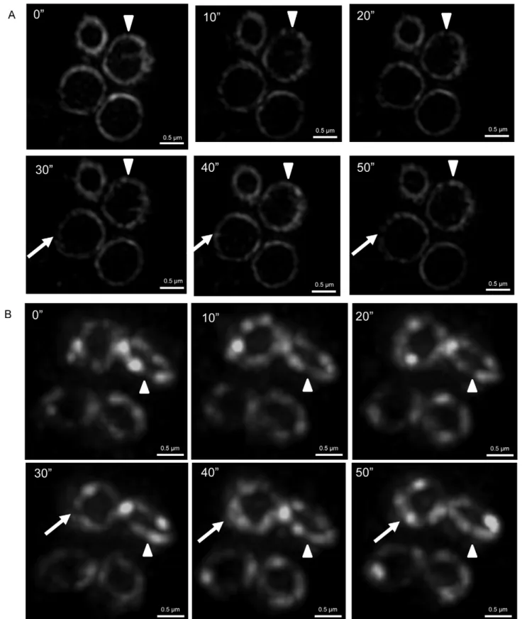 Figure 5. Z ring dynamics in S. aureus . (A) 3D-SIM (OMX Blaze) time-lapse images show how FtsZ localization changes within the Z ring in S.