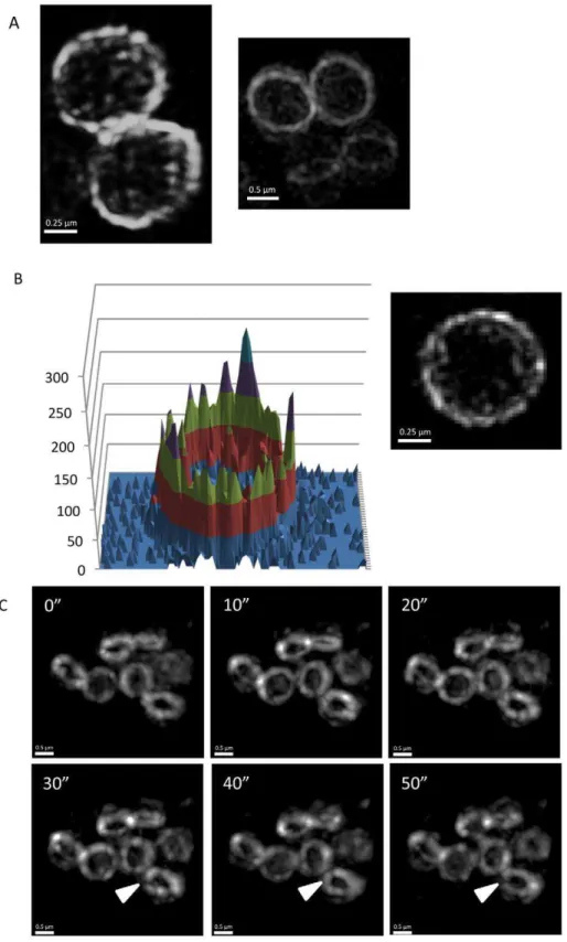 Figure 8. PBP2 rings in S. aureus are also heterogeneous and show dynamic movement. (A) To examine GFP-PBP2 localization using 3D- 3D-SIM (OMX V3), S