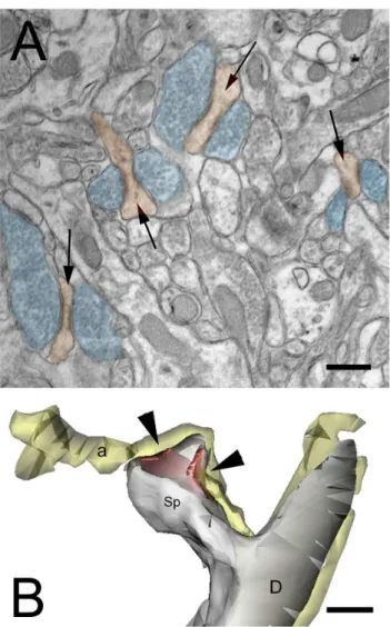 Figure  5.    Abnormal  spines  in  stratum  radiatum  of  the WAVE-1  KO  mouse.    A