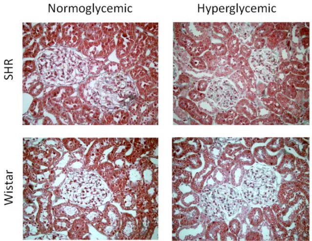 Figure 3. Histological study. Representative images of renal tissue sections stained with Masson’s trichrome 3 months after the inception of hyperglycemia (or not, as control) in Wistar and SHR rats