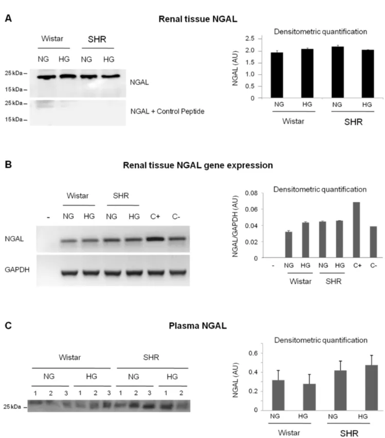 Figure 6. Renal and plasma NGAL are not modified by hyperglycemia and hypertension. Renal tissue NGAL protein levels (A; n = 4–5 per group), renal NGAL gene expression analysis (B; n = 3) and NGAL plasma level (C; n = 2–3 per group), in normoglycemic (NG) 