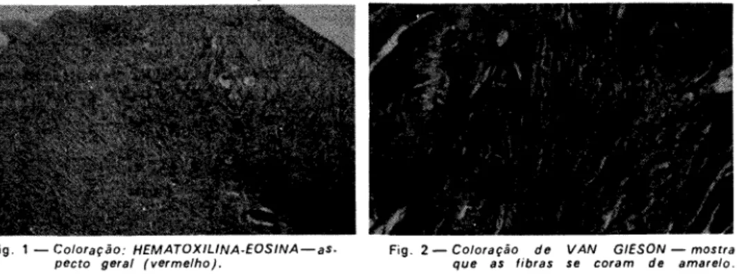 Fig. 1 —  C o l o r a ç ã o : HEMATOXILINA-EOSINA  — a s - -pecto  g e r a l  ( v e r m e l h o ) 