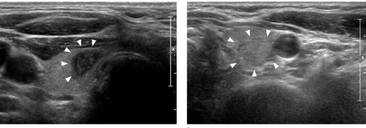 Fig. 2. Representive sonograms of thyroid nodules with repeat nondiagnostic results.