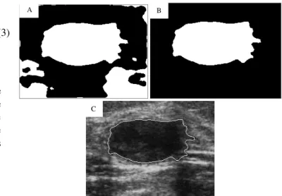 Fig. 3.  A contour delimited by a radiologist (a) and marking of the lesion  area extracted (b)