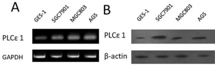 Figure 1. Expression analysis of PLC e 1 protein and mRNA in gastric normal and cancer cell lines