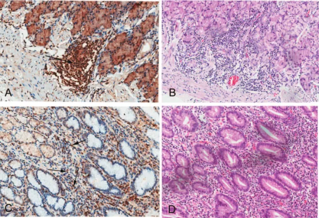 Table S1 The relationship between PLCe1 expression and clinicopathologic characteristics.