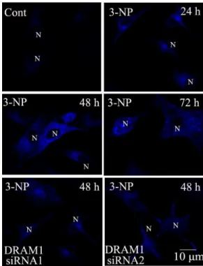 Figure 7. Knock down DRAM1 inhibited lysosomal acidification and cathepsin D activation