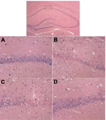 Figure 4. Immunohistochemical staining of the CA1 region of the hippocampus ( 6 400). A, B, and C, staining for Ab 1–42 , IDE, and PPARc, respectively