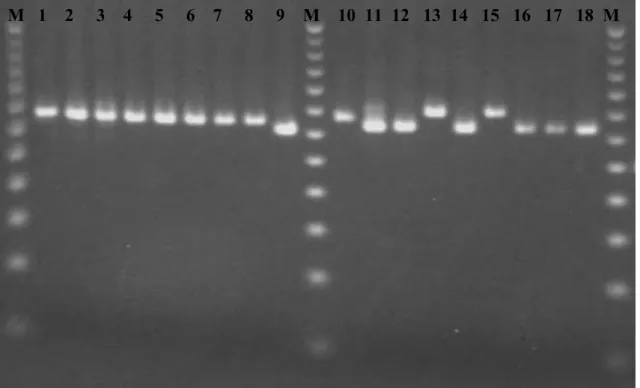 Fig.  6  –  Eletroforese  em  gel  de  agarose  representativa  dos  resultados  de  MLVA  dos  loci Bruce04 e Bruce07