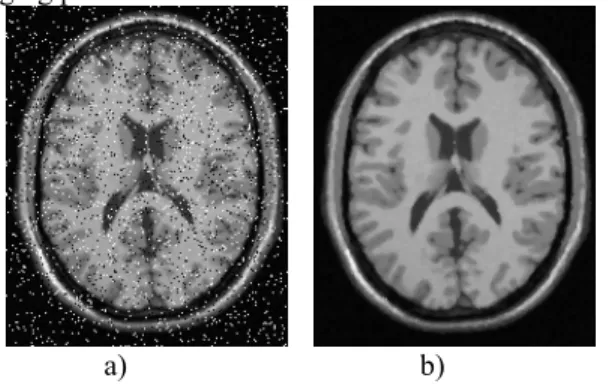 Figure 1: a) T1 MRI image with salt and paper noise, b) Median filtered  image. 