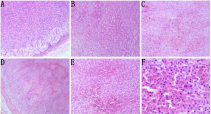 Figure 4. Adrenal gland histopathology (H&amp;E staining). A: