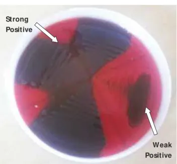 Fig. 1: Tube Adherence Method for biofilm  detection: Left side of the image shows  positive and negative controls
