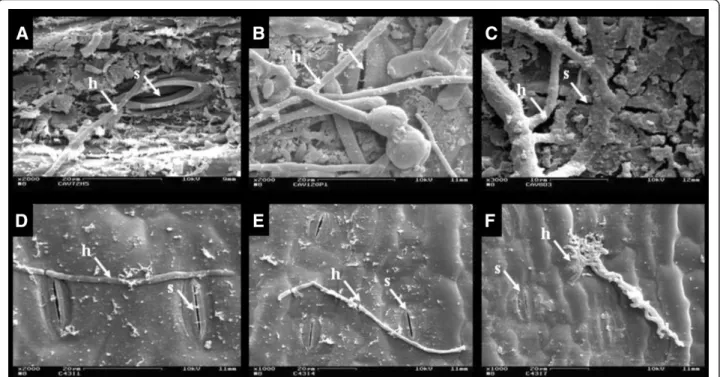Figure 6 Scanning electronic microscopy (SEM) observation of interaction of Mycosphaerella musicola with abaxial leaf surfaces of Musa acuminata genotypes