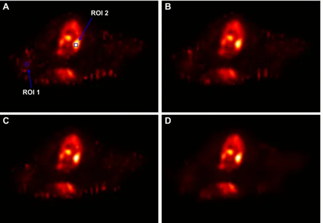 Figure 11. The K i parametric images estimated by different algorithms. (A) is the result from the direct OSEM reconstruction; (B) is the result from the OSEM image filtered by the GF algorithm (s g ~0:5 voxel); (C) is the result from the OSEM image filter