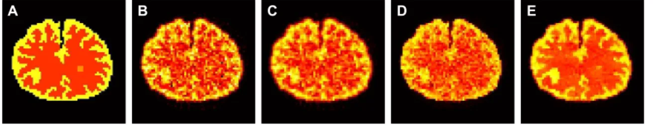 Figure 8. The ground truth and the estimated K i parametric images from the activity images reconstructed by different algorithms.