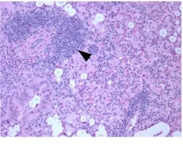 Figure 6. Histopathological findings in the lungs of wild-type and TLR9 knockout mice 12 days following challenge with 210 4 C.