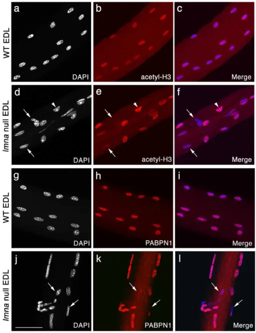 Figure 3. Variable transcriptional activity and mRNA processing between myonuclei of lmna -null mice