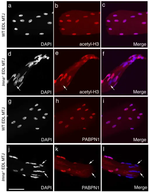 Figure 4. Transcriptional activity and mRNA processing are often impaired in myonuclei at the myotendinous junctions of lmna -null mice