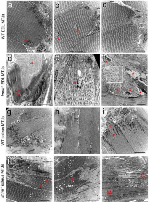 Figure 5. Myotendinous junction structure is abnormal in lmna 2/2 mice. Representative TEM images of longitudinal sections of myotendinous junction (MTJ) from EDL (a–c) and soleus (g–i) myofibres of wild-type (WT) lmna +/+ mice
