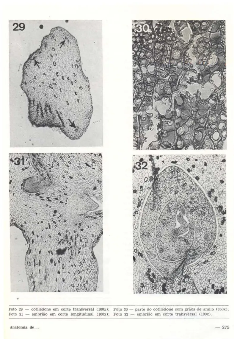 Foto  31  - embrião  em  corte  longitudinal  (100x);  Foto  32  - embrião  em  corte  transversal  (100x)