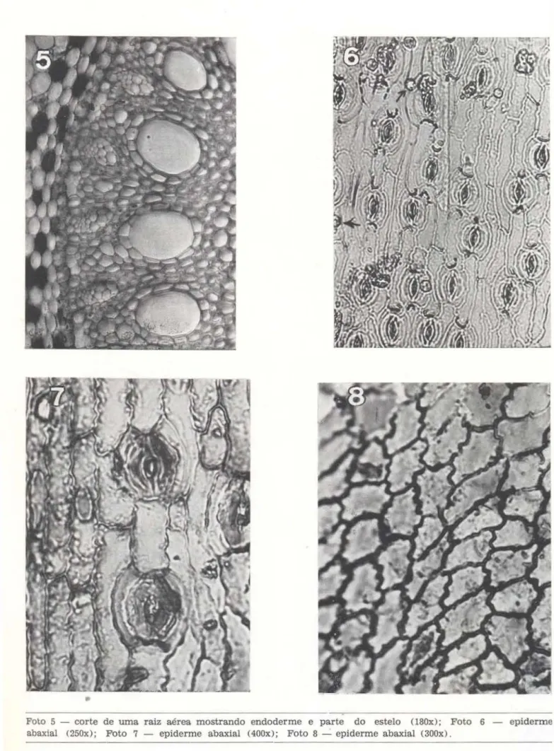 Foto  5  - corte  de  uma  raiz  aérea  mostrando  endoderme  e  parte  do  esteio  (180x);  Foto  6  - epiderme  abaxial  (250x);  Foto  7  - epiderme  abaxial  (400x);  Foto  8 - epiderme  abaxial  (300x)