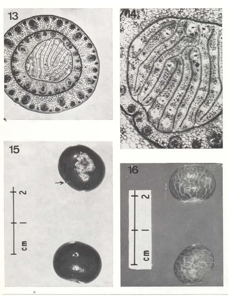 Foto  13  - corte  da  folha-axial  de  espécime  jovem  mo~trando  as  dobras  das  pinas  (86x);  Foto  14  - corte  da  folha-axial  de  espécime  adulto,  onde  se  vêem  dobras  das  pinas  e  uma  bolsa  (138x);  Foto  15  - fruto  