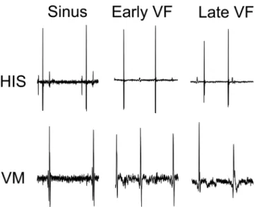 Figure 4. Mean and standard deviation of His and VM activation rate during eight minutes of unperfused VF