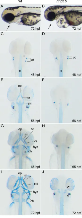 Figure 1. Ring1b mutants lack almost all head cartilage elements. Lateral view of WT and ring1b live embryos at 72 hpf (A, B)