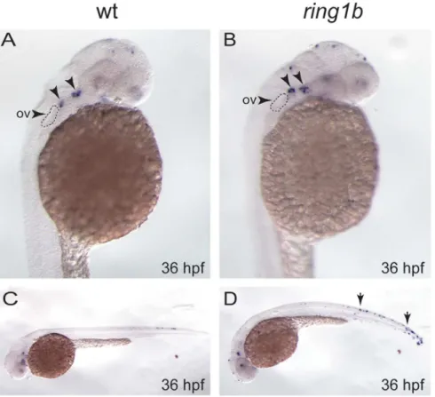 Figure 7. Apoptosis is slightly increased in the pharyngeal arch of ring1b mutants. Lateral views of WT and ring1b embryos at 36 hpf stained for TUNEL