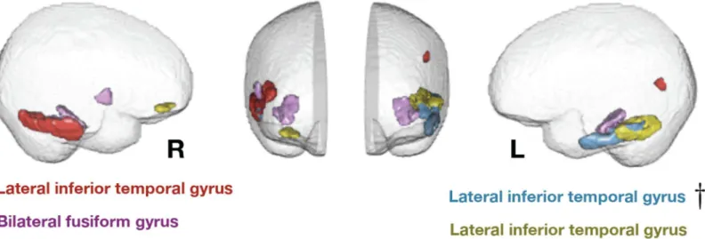 Table 1. Cortical eigenanatomy related to environmental stimulation in the home at age 4