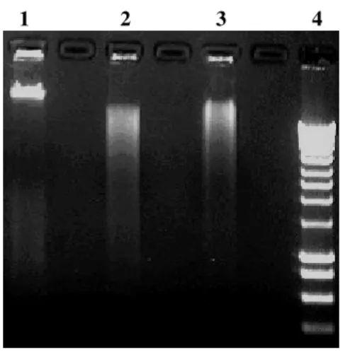 Fig 4: Restriction analysis of DNA extracted from agarose gel. Lanes: 