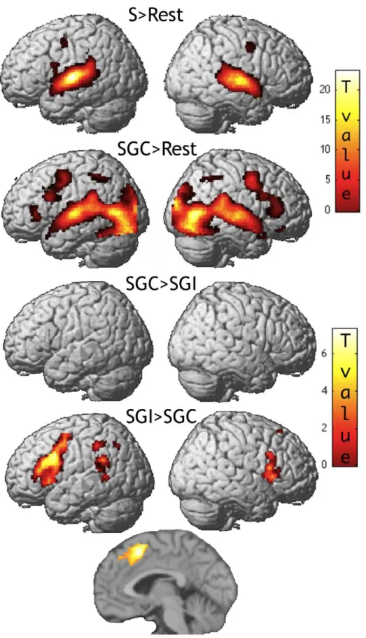 Figure 3. Initial Phase. SPM renderings with one medial section to show SGI.SGC activation in the supplementary motor area