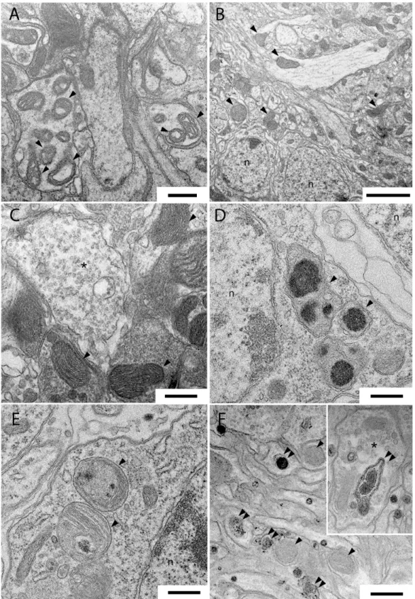Fig 5. Samples of transmission electron microscopy images of thoracic ganglia and antennal lobes in Drosophila LRRK2 mutant (A) and after treatment with 1% in L - /A + insects (B, C) and 10% L + /A + (D-F) extract of Wse