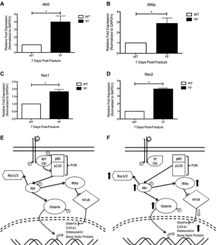 Fig 7. Molecular and functional changes in osteoblasts and osteoclasts of YF fracture calluses may be due to increased PI3K signaling