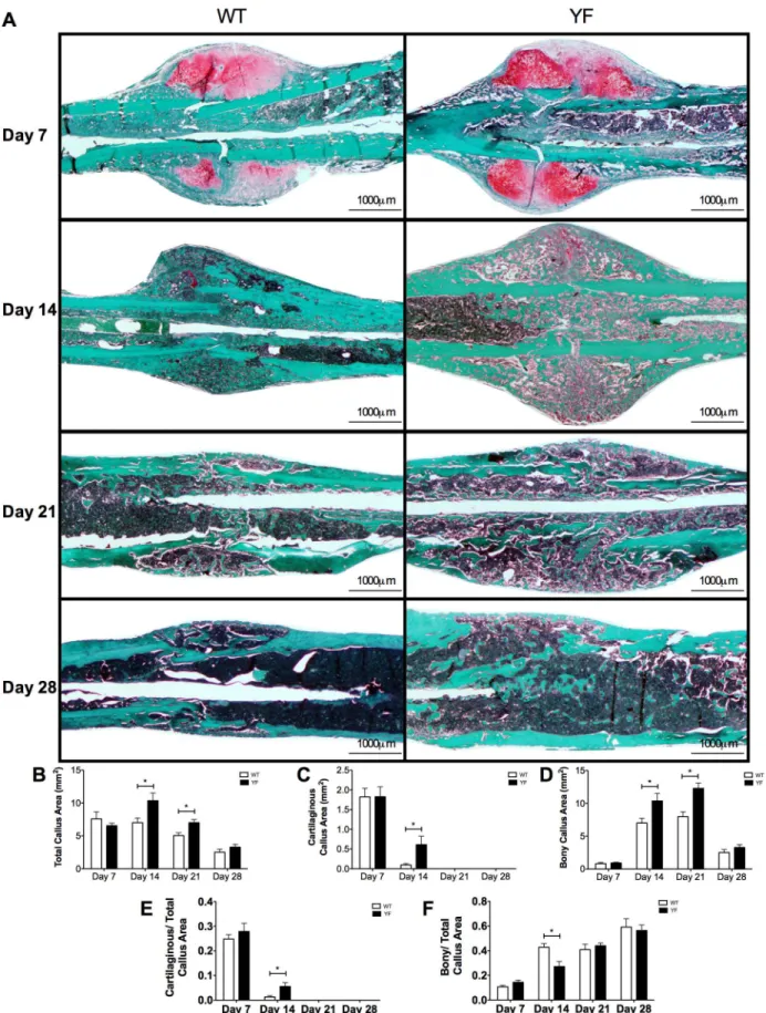 Fig 3. Increased cartilaginous and bony matrix in remodeling fracture calluses of YF mice