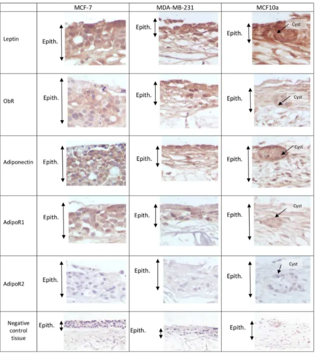 Figure 3. Immunohistochemical staining of the tridimensional adipose skin equivalent using affinity-purified polyclonal biotinylated antibodies raised against Leptin, Ob-Rt, Adiponectin, AdipoR1, AdipoR2