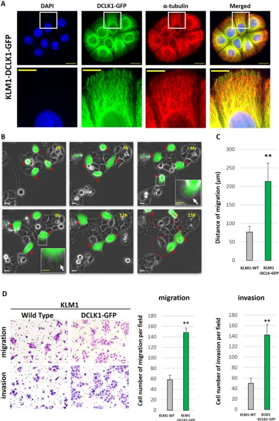 Fig 5. Gain-of-function analysis shows the effects of DCLK1 overexpression in KLM1 (KLM1-DCLK1-GFP) cells in vitro