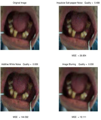 Table 3: Results of denture images related to figure 6. 