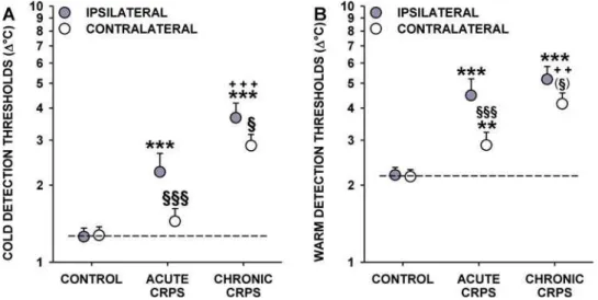 Figure 3. Thermal pain thresholds in acute and chronic CRPS. Cold pain thresholds (A) and heat pain thresholds (B) are significantly lowered in acute CRPS (corresponding to cold and heat hyperalgesia)