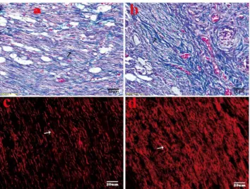 Figure 5. Gene expression of MAG, MBP, MP22 and NCAM-1 in neuromas. Within the two groups, real-time quantitative PCR demonstrated that the expression of myelin-specific genes: MAG, MAP and PMP22, was markedly up-regulated and the expression of NCAM-1 was 