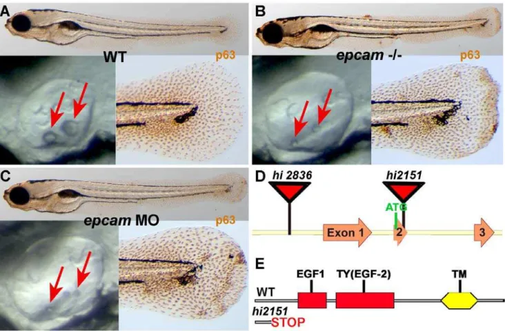 Figure 1. epcam mutants and morphants display smaller otoliths and keratinocyte aggregation