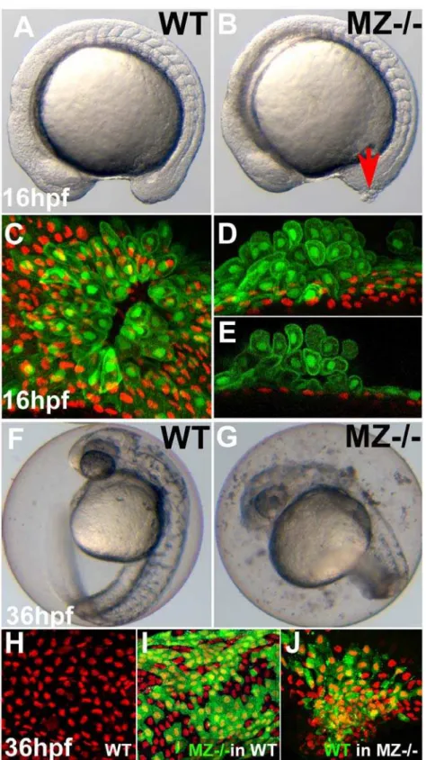 Figure 3. First cell aggregates of maternal/zygotic epcam mutants are formed during mid segmentation stages, starting in the EVL, whereas basal cell aggregates form secondarily