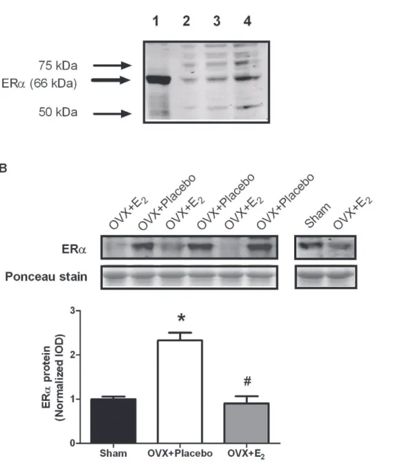 Figure 5E) as was ERa gene expression (P $ 0.176; Figure 5F).