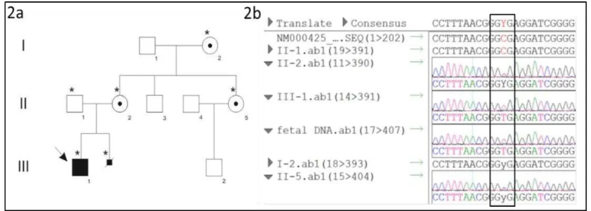 Figure  2(a)  Family  tree.  Filled  squares  indicate  affected  males;  arrow  indicates  proband;  *indicates  individuals  whose  DNA  was  available  for  the  genetic  analysis